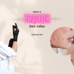 Masz nawrót trądziku? Oto 3 rzeczy, o których musisz wiedzieć!
