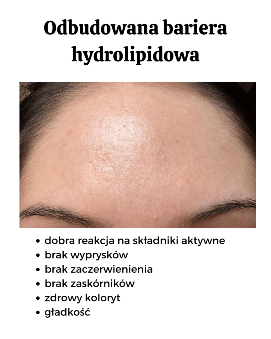 odbudowana bariera hydrolipidowa, przed i po,
